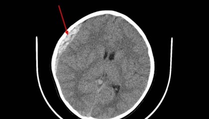 心碎！浙江2岁妹妹，3岁哥哥遇难…紧急提醒：不要去，不要去