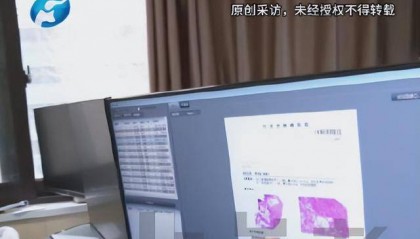 爸爸常年在家吸烟，13岁女儿吸13年二手烟腹腔内长满肿瘤