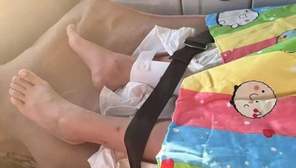 男子火车上铺跌落砸断10岁女孩腿骨,回应“失联”称失业讨薪中