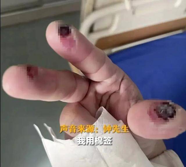 半岛公开课丨女子误碰“化骨水”身亡！警惕身边这些危险化学品