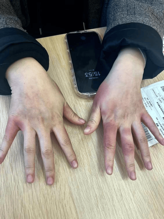 东北姑娘来浙江后崩溃了，穿3条加绒裤还冻到发抖！南方人冬天怎么保命，网友吵翻！